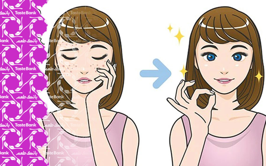 درمان جوش صورت در دوره جوانی